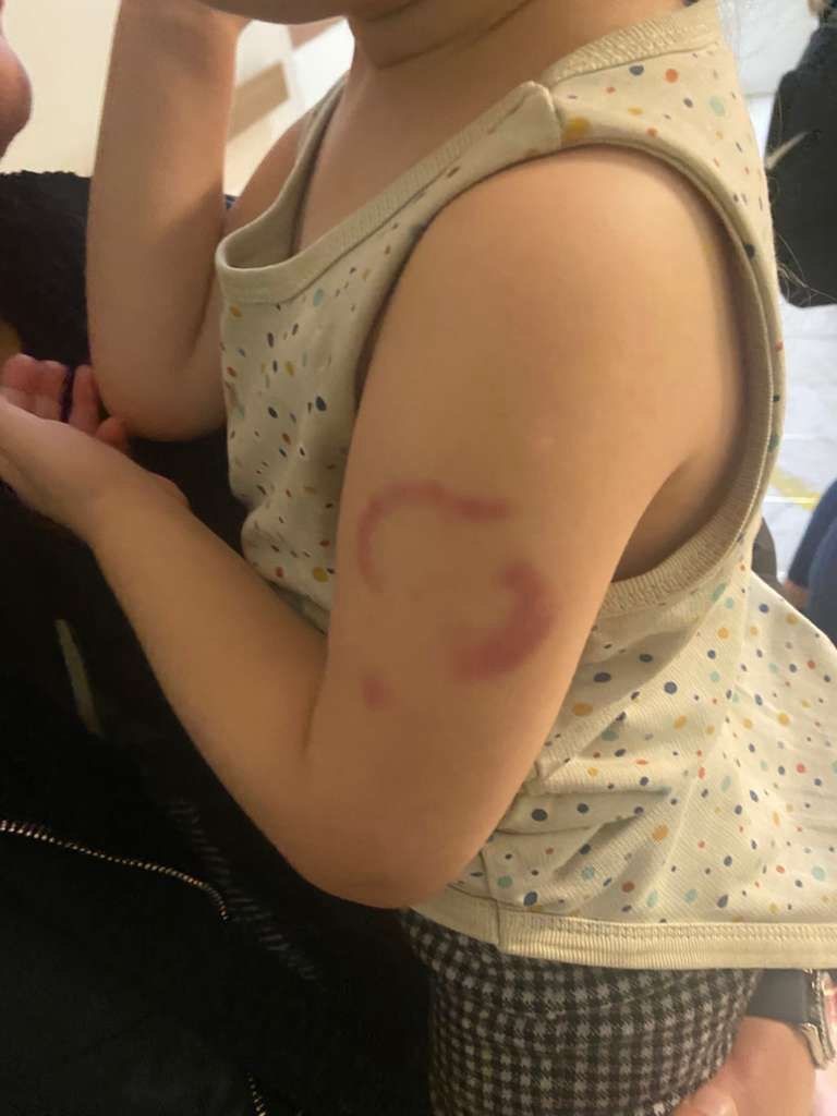 Şok savunma: Isırmadım, öperken oldu!